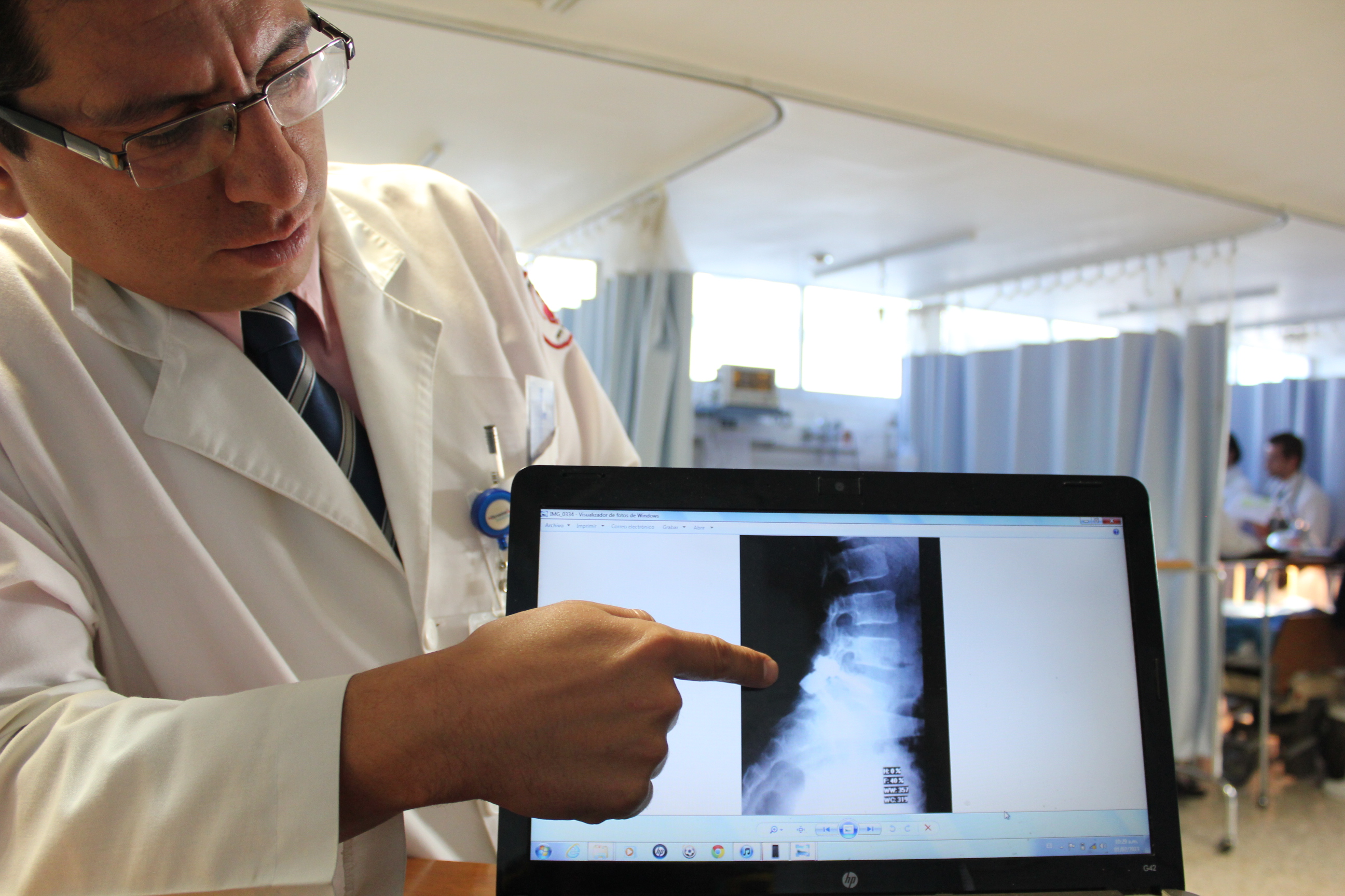 Cirugía de columna con implante transpedicular a un infante