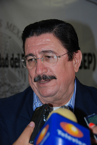 Solicitó ISSEA nuevo tomógrafo, mientras el otro continúa desaparecido