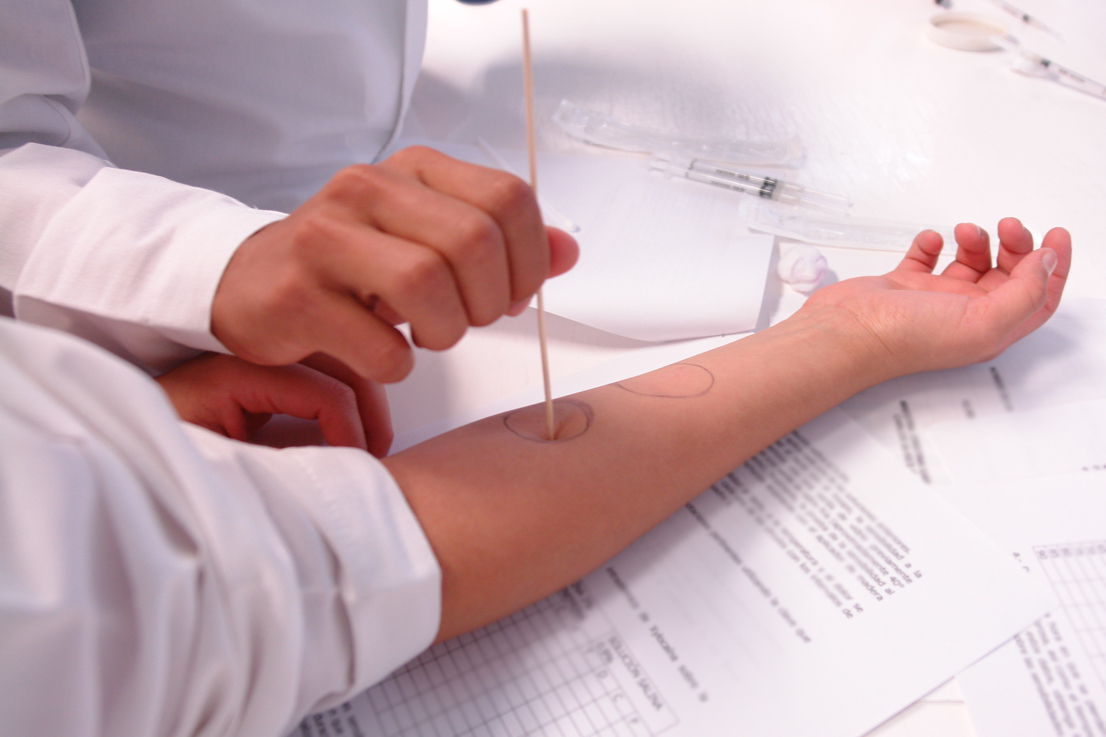 UAA investigará al hongo que causa úlceras en la piel