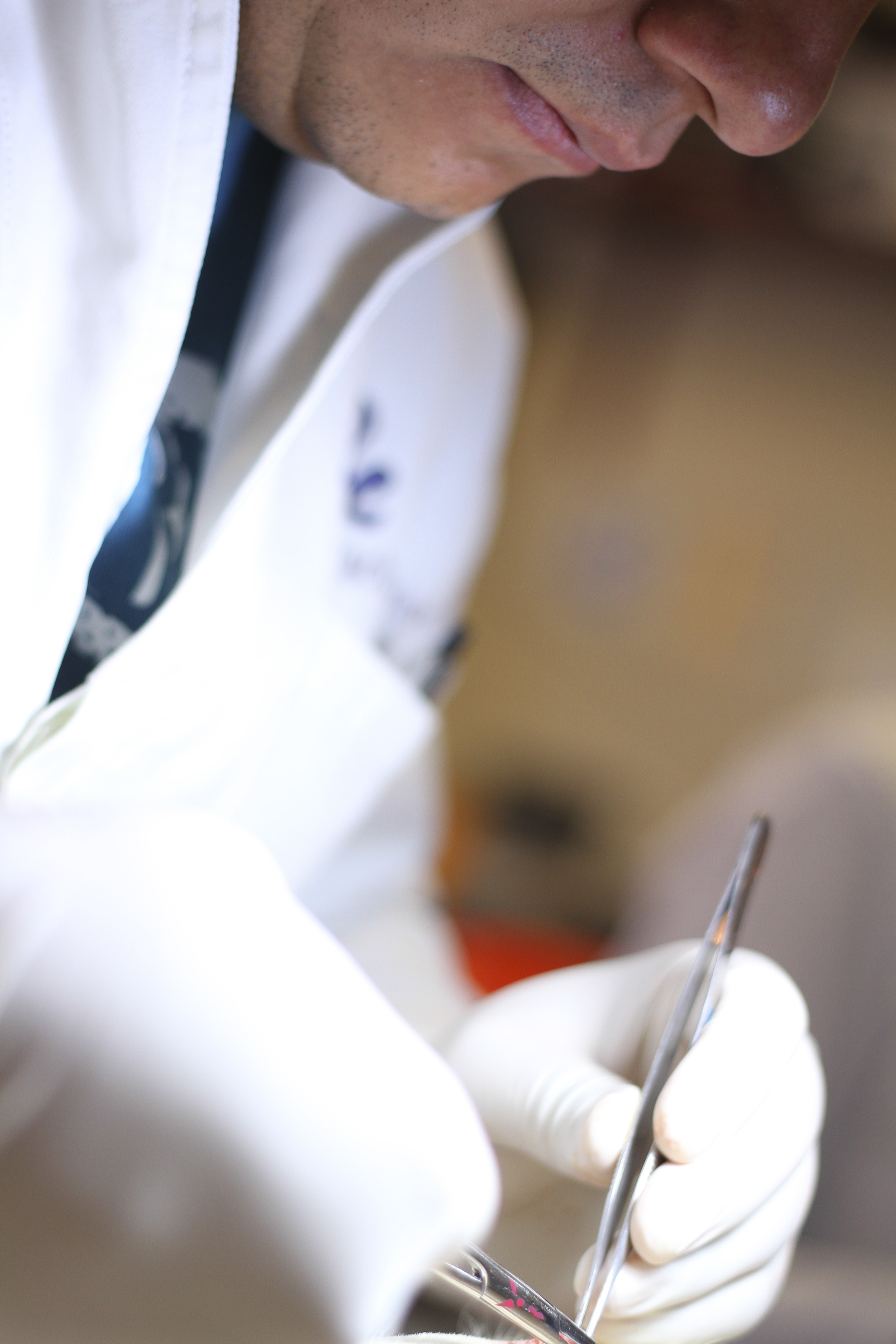 Descubren nuevo modelo de atención contra la cirrosis hepática