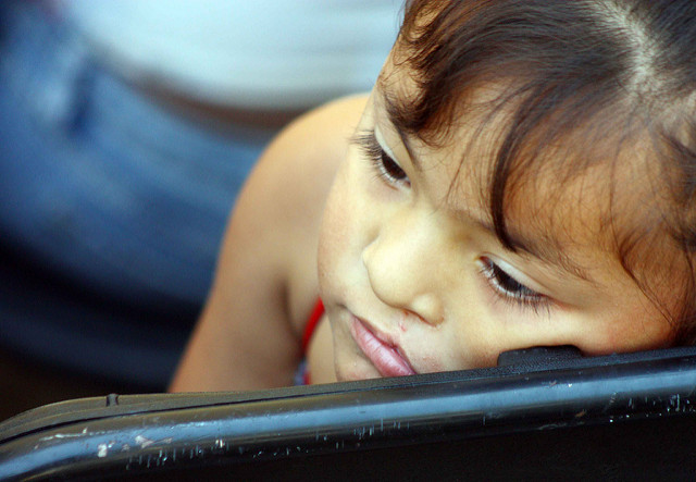 Al año, se atienden cerca de 460 casos de labio y paladar hendido en el estado