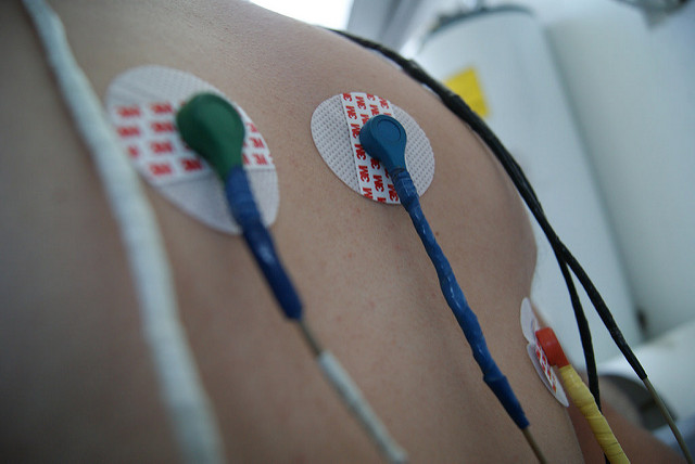 En México han disminuido 58% las fatalidades por enfermedades cardiovasculares