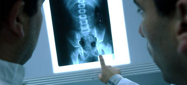 Entregan vales de descuento para estudio de osteoporosis