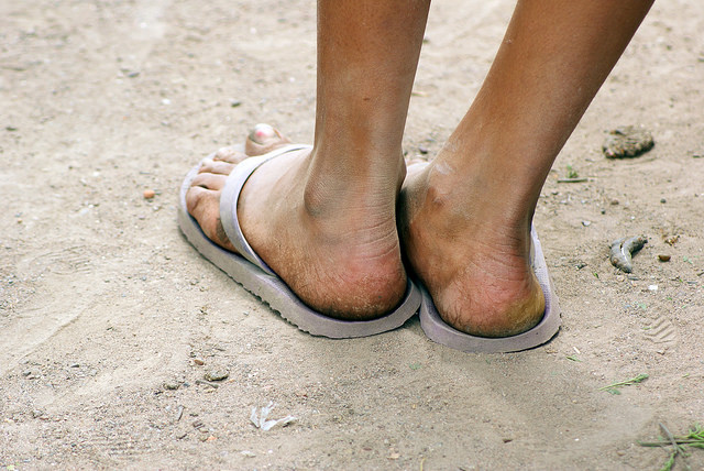 La pobreza no desaparecerá mientras el consumo siga siendo prioridad en el modelo económico