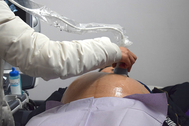 Las mujeres deben ser libres de elegir dónde, con quién y cómo parir