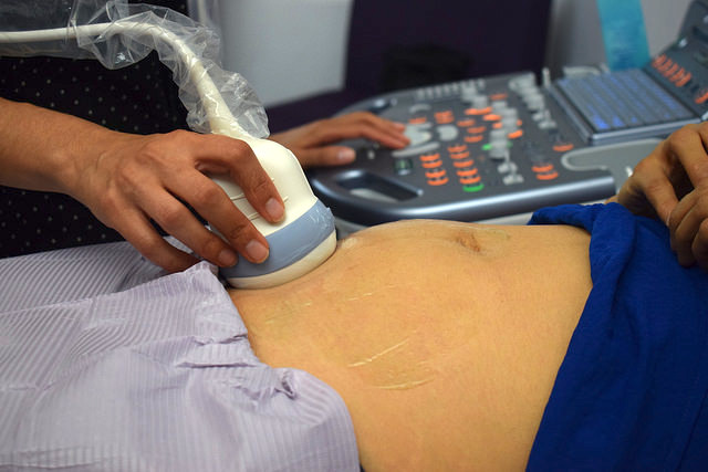 Registró Aguascalientes 18 muertes maternas en los últimos tres años