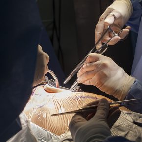 29372479053_a1d35cf8ac_z