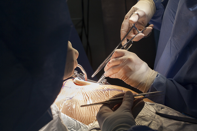 Cáncer de colon, el tercero más frecuente en México