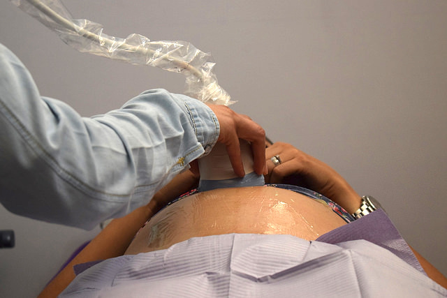 Secretaría General de Conapo debe informar gasto presupuestal de estrategia para prevenir embarazo en adolescentes