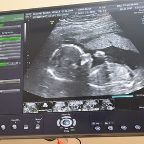 37474578576_cc9ce99018_z