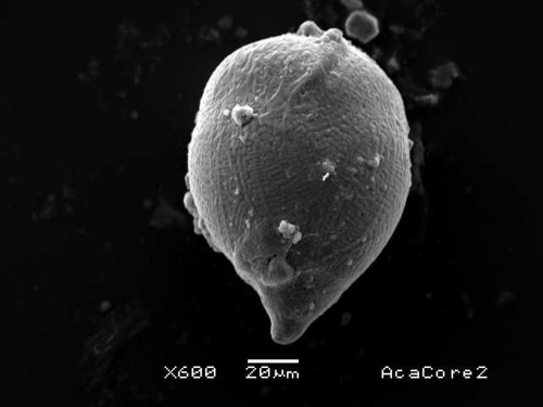 Serpina3k, la molécula que detecta daño renal a tiempo