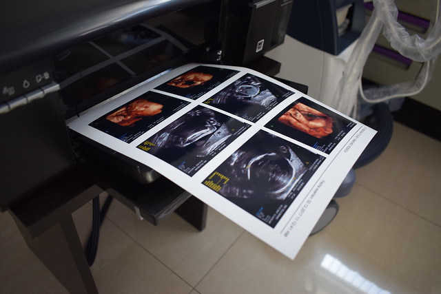 En México, 9.6% de las adolescentes de 15 a 17 años, ha estado embarazada al menos una vez