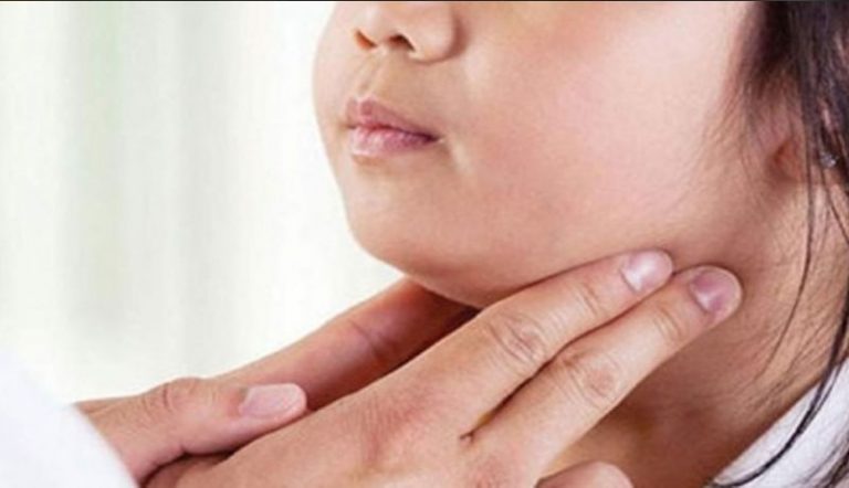 Sin brote de paperas en el estado: Instituto de Salud de Aguascalientes