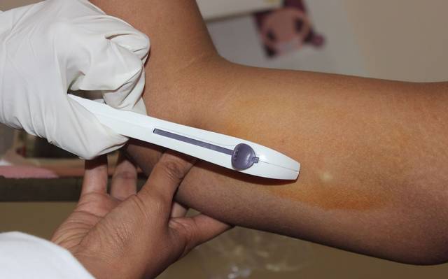 Realizan jornada de anticoncepción en Hospital de la Mujer de Aguascalientes