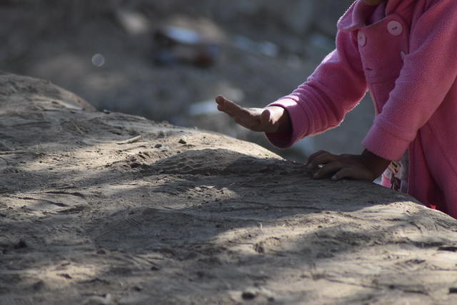 Fideicomiso “Ayuda a un Niño” entrega prótesis oculares en Aguascalientes