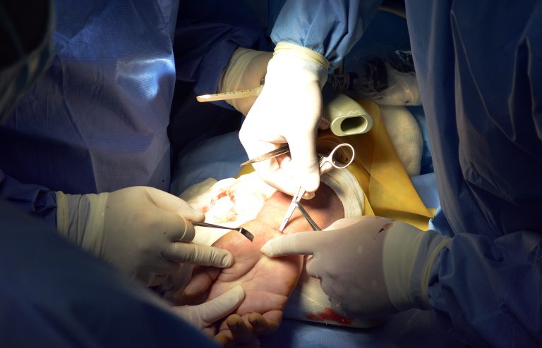 Recomiendan cuidar manos para evitar daños irreversibles