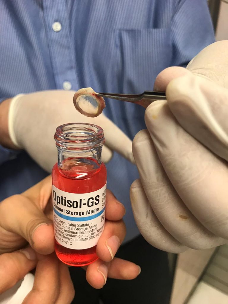 Procuró IMSS dos córneas  en Aguascalientes