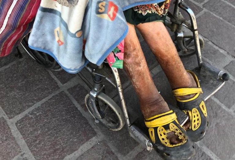 DIF Aguascalientes atiende y da seguimiento a reportes de adultos mayores vulnerables      