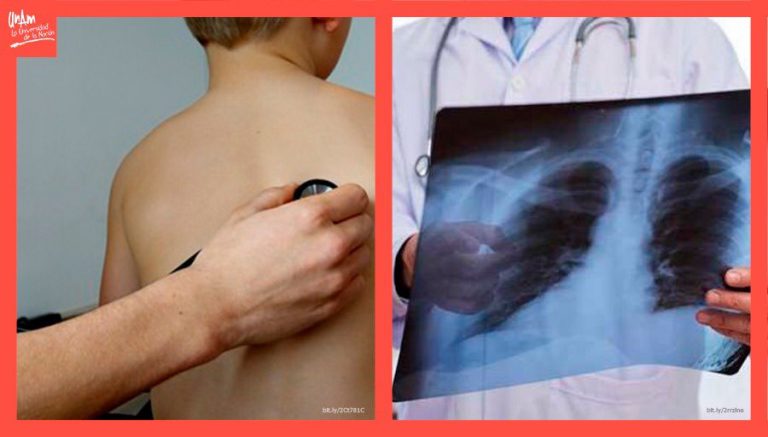 La neumonía, novena causa de mortalidad en México   