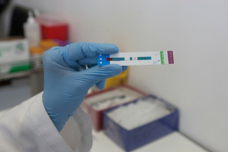 Descubren nueva cepa del VIH, la primera en 20 años