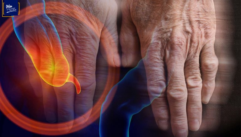 La extirpación del apéndice podría proteger contra el parkinson   