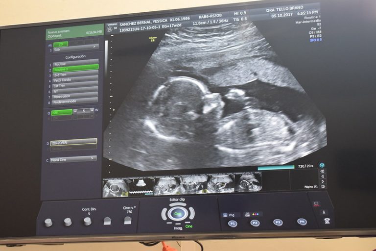 Trabajan iniciativa para sancionar abandono a embarazadas en Aguascalientes