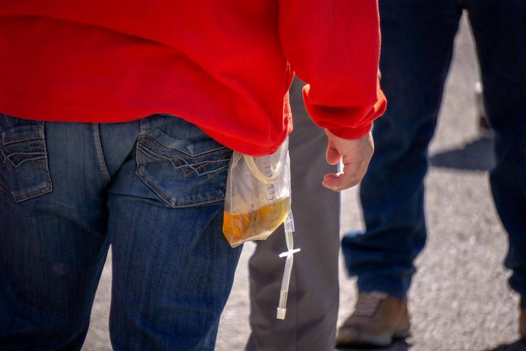 Urge una comisión especial sobre enfermedades renales en Aguascalientes 