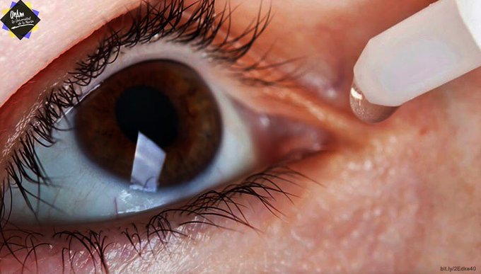 Padece ojo seco más de la mitad de los jóvenes mexicanos   