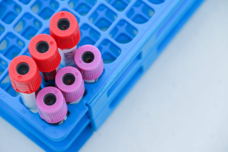 UAA realiza campaña de donación altruista de sangre