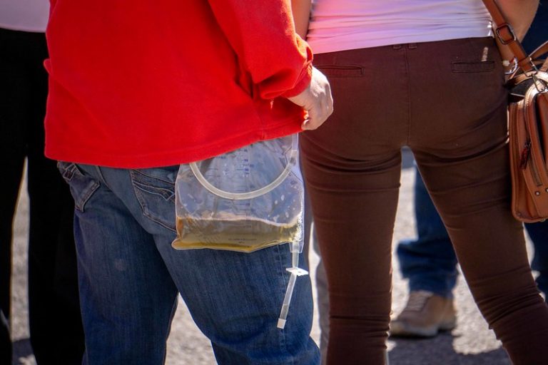 Escasean medicamentos para padecimientos renales en Aguascalientes