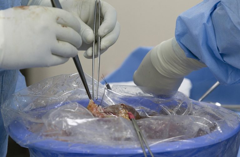 Aumenta donación de órganos y tejido en el ISSSTE