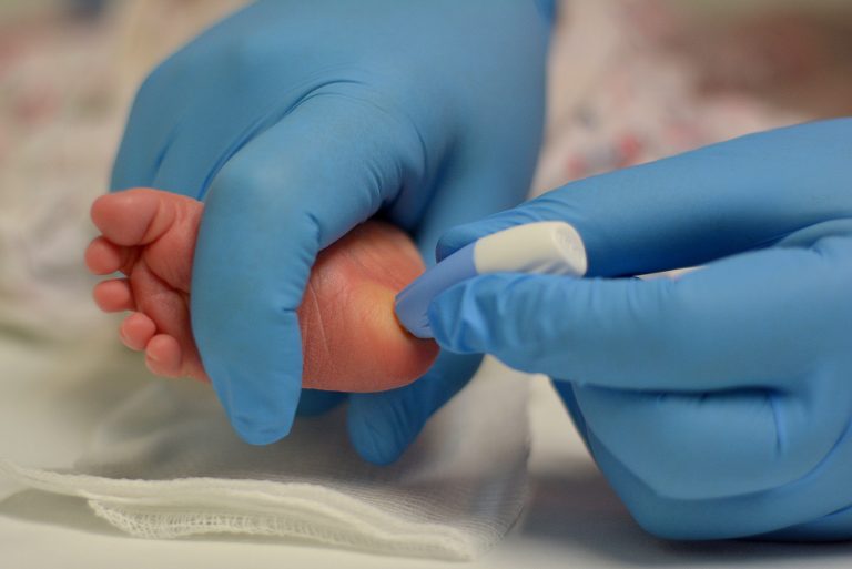 El ISSSTE aplicará el Tamiz Neonatal Metabólico ampliado para detectar Enfermedades Raras