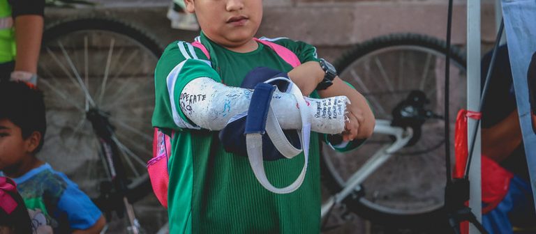 IMSS ofrece tratamiento preventivo a segundas fracturas