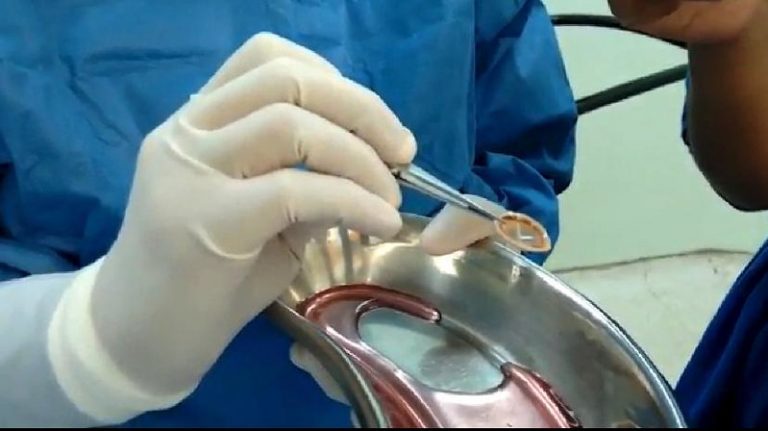 Por Covid-19, se posponen trasplantes de órganos en Aguascalientes