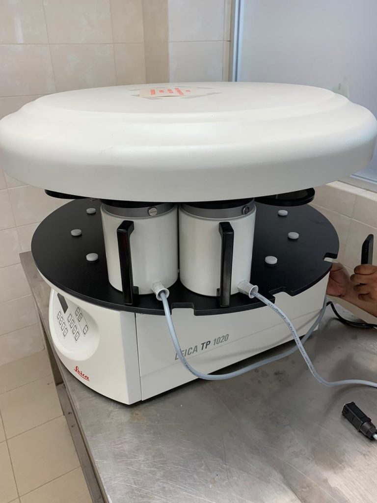 Adquiere el Issste 50 ventiladores más de terapia intensiva durante pandemia por COVID-19