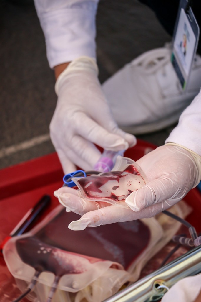 Lamenta Issea que la Cofepris no avale el uso de plasma convaleciente en Aguascalientes