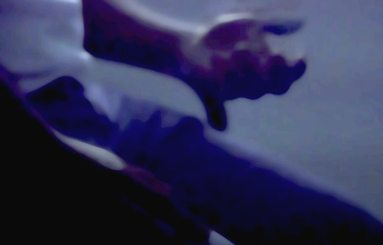 Voluntario narra ensayo de vacuna: “Es una forma de ayudar a la investigación”