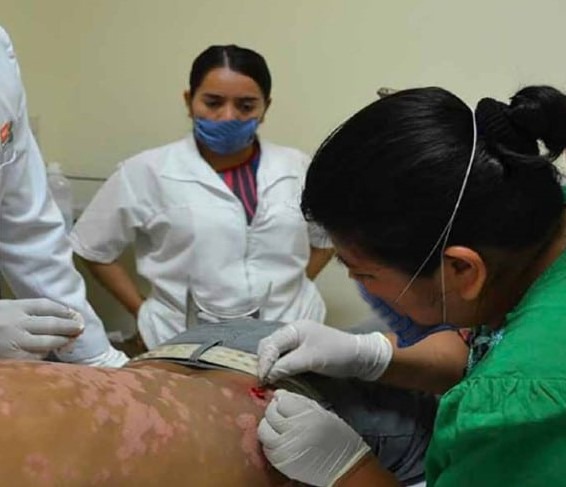 Ofrece Issea tratamiento gratuito contra la lepra en Aguascalientes