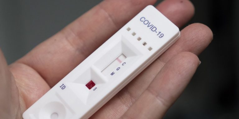 Ha disminuido la demanda de pruebas PCR para confirmar coronavirus en Aguascalientes: Issea