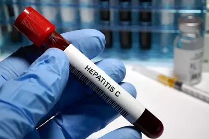 Ofrece Issea tratamientos gratuitos para curar la hepatitis C en Aguascalientes