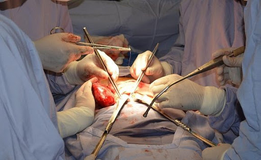 Llaman especialistas a redoblar cuidados preventivos de la insuficiencia renal