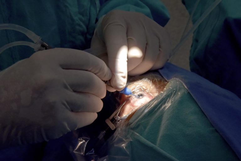 Adultos mayores, principales beneficiarios de las cirugías de cataratas