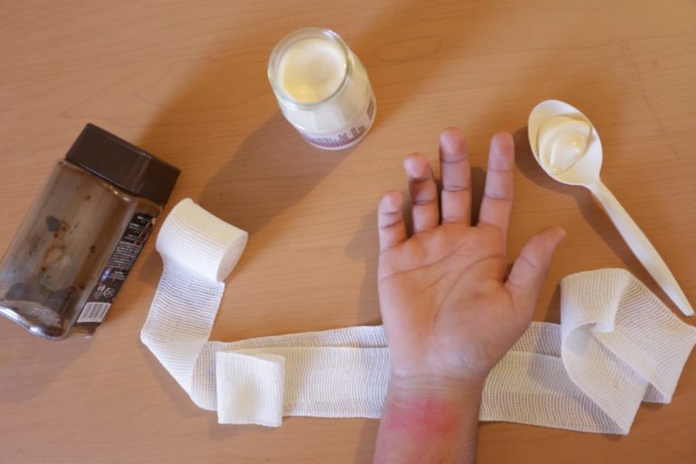 Protección Civil de Aguascalientes realizó recomendaciones sobre primeros auxilios