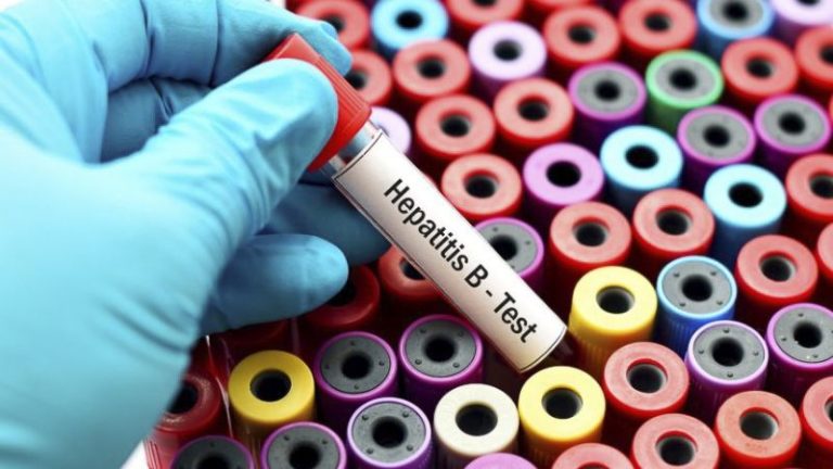 Cada 30 segundos muere en el mundo una persona por hepatitis o sus complicaciones