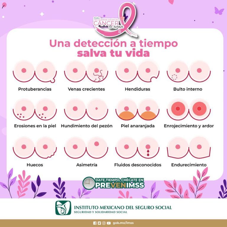 Exhorta IMSS Aguascalientes realizar autoexploración para detectar a tiempo el cáncer de mama
