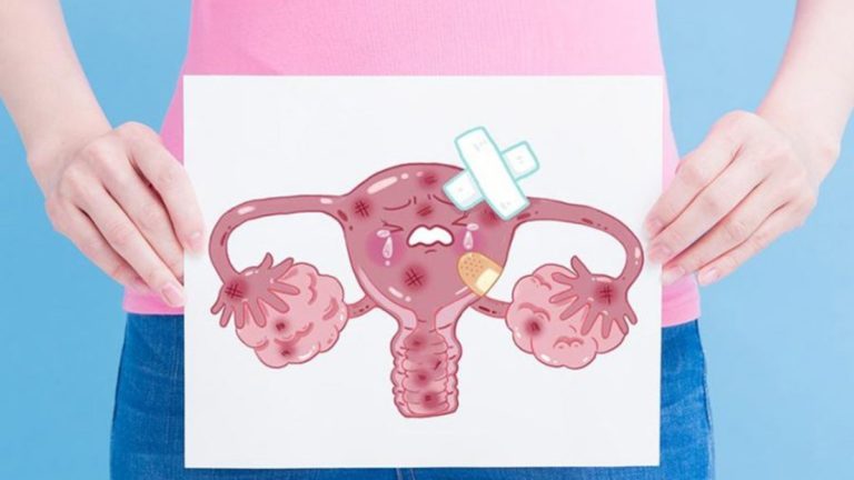 Cáncer cervicouterino en edad reproductiva, segunda causa de muerte en México 