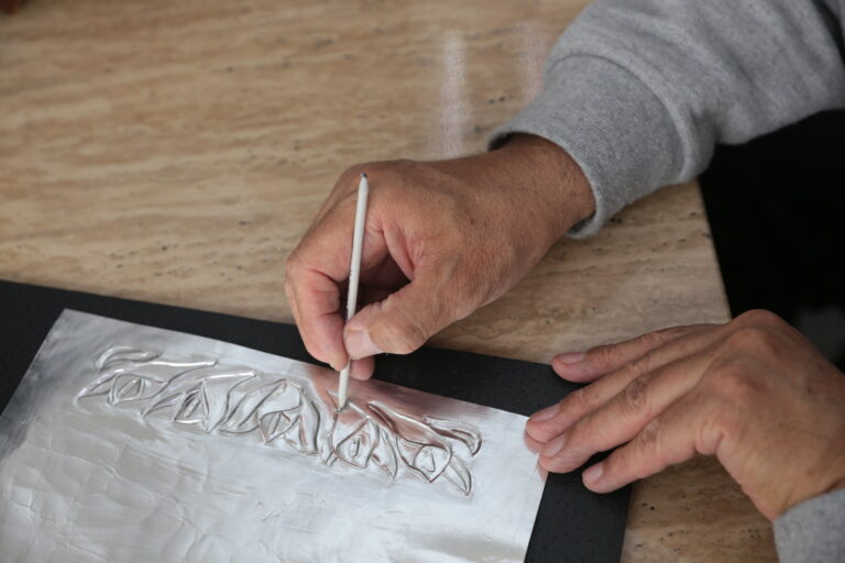 ISSSTE aplica tratamientos para control de síntomas a enfermos de párkinson  