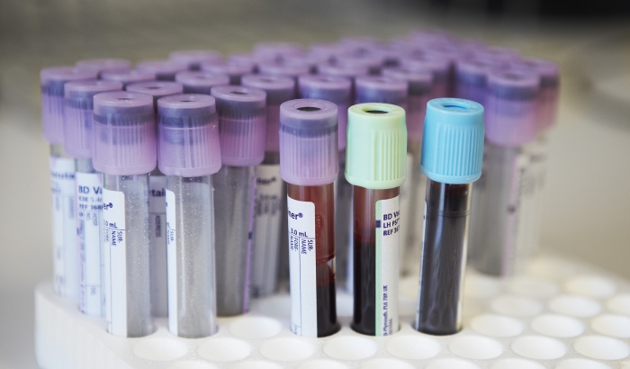 1° de diciembre, Día mundial de la respuesta ante el VIH y el sida