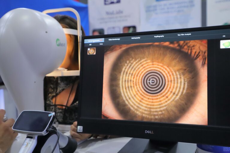 UAA ofreció más de 300 consultas para detectar glaucoma