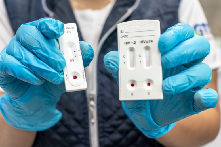 En Guanajuato, SSG atiende a 3,681 guanajuatenses portadores del VIH.